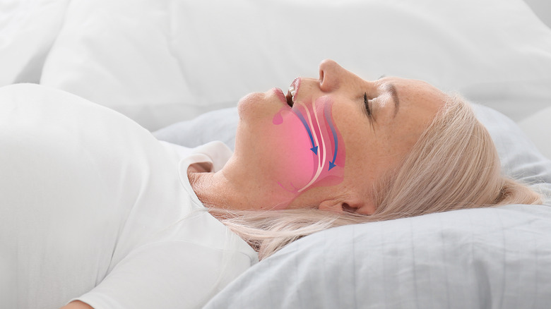 Woman with sleep apnea sleeping