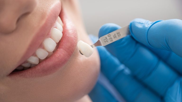 woman with dental crown held close to mouth