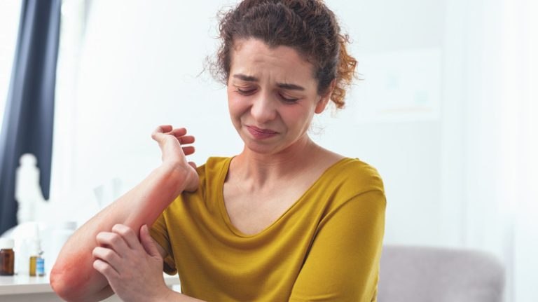 Sad young woman scratching rash